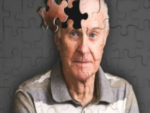 Признаки болезни Альцгеймера