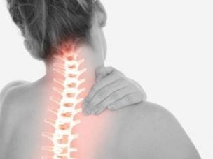 Шейный остеохондроз - причины возникновения, симптомы и методы лечения