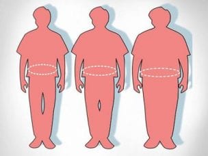 Стадии ожирения у мужчин - степени и формы патологии, методы лечения