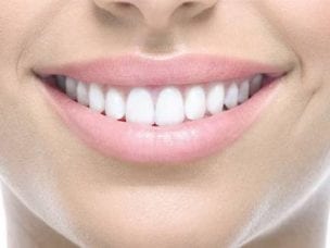 Восстановление эмали зубов - профессиональные и народные способы