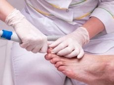 Вросший ноготь на большом пальце ноги — удаление хирургическим  путем